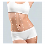 Abdominoplastia con Liposucción